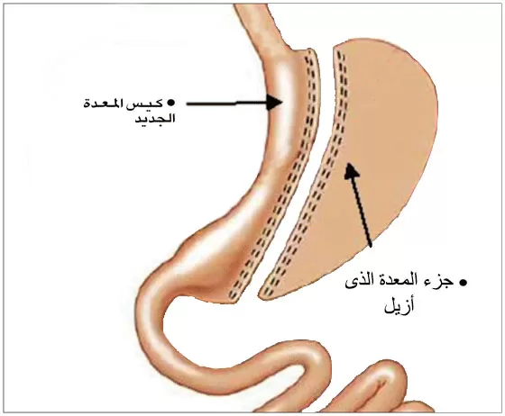 مدار الساعة,أخبار الأردن,اخبار الاردن,اضطرابات النوم