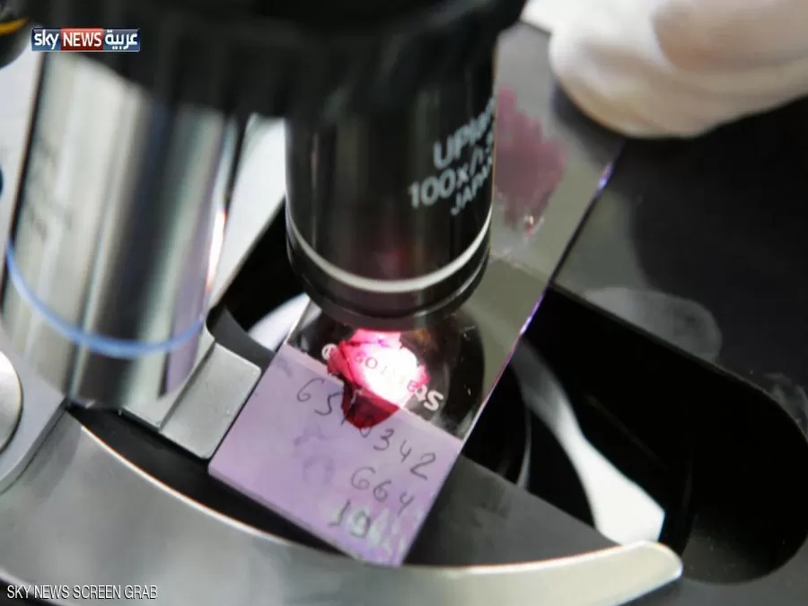 مدار الساعة,أخبار عربية ودولية,وزارة الصحة,منظمة الصحة العالمية