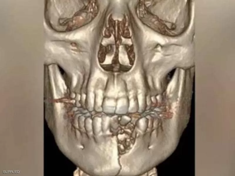 مدار الساعة,أخبار خفيفة ومنوعة