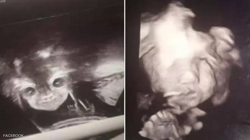 مدار الساعة,أخبار خفيفة ومنوعة,مواقع التواصل الاجتماعي