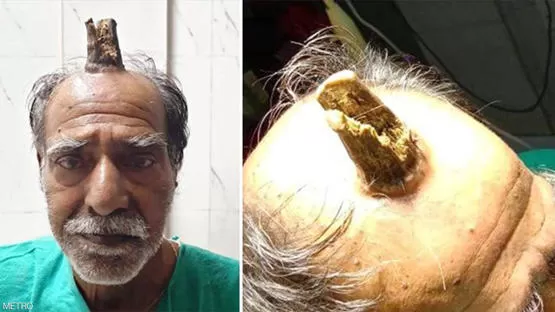 مدار الساعة,أخبار خفيفة ومنوعة